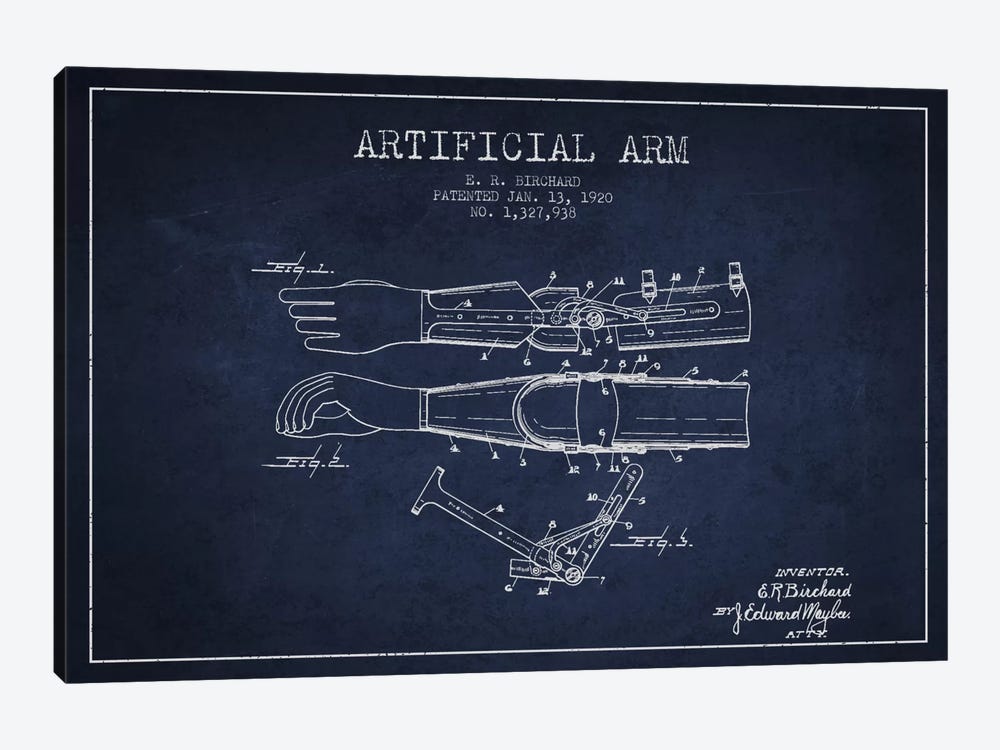 Artificial Arm Navy Blue Patent Blueprint by Aged Pixel 1-piece Art Print