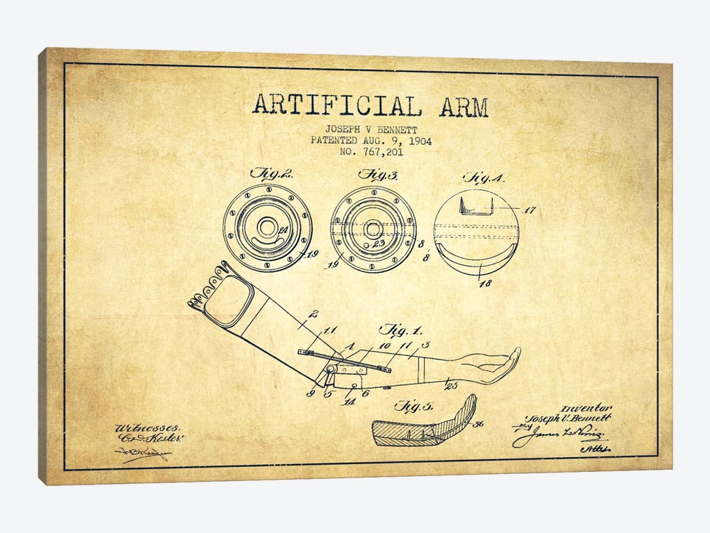 Artificial Arm Vintage Patent Blueprint by Aged Pixel 1-piece Art Print