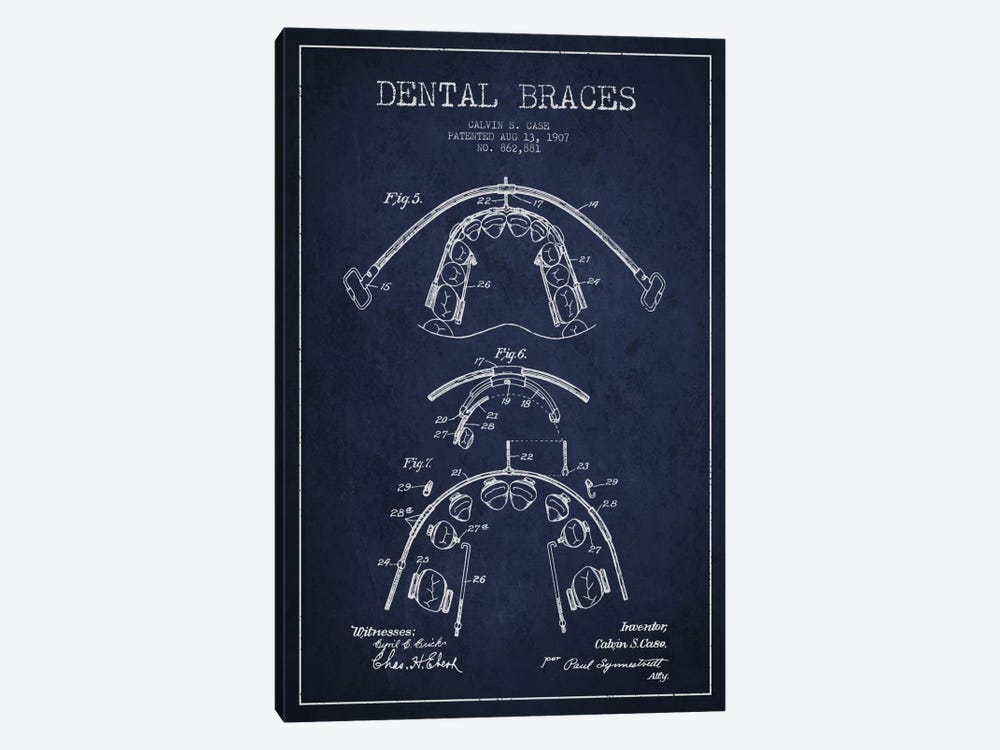 Dental Braces Navy Blue Patent Blueprint by Aged Pixel 1-piece Canvas Artwork