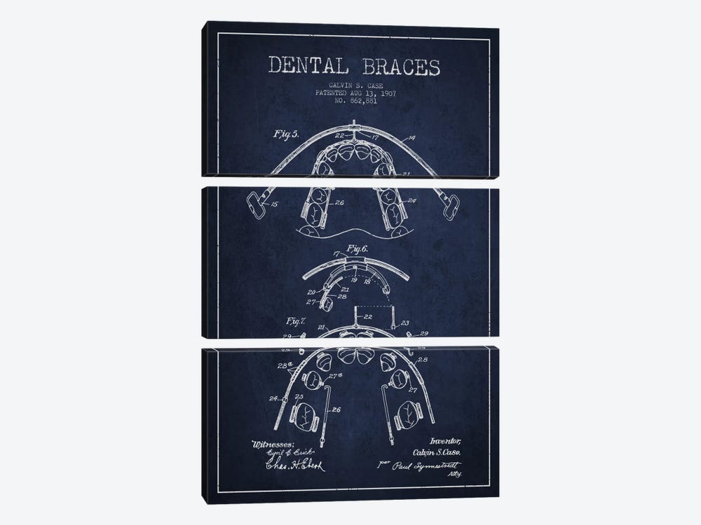 Dental Braces Navy Blue Patent Blueprint by Aged Pixel 3-piece Canvas Art