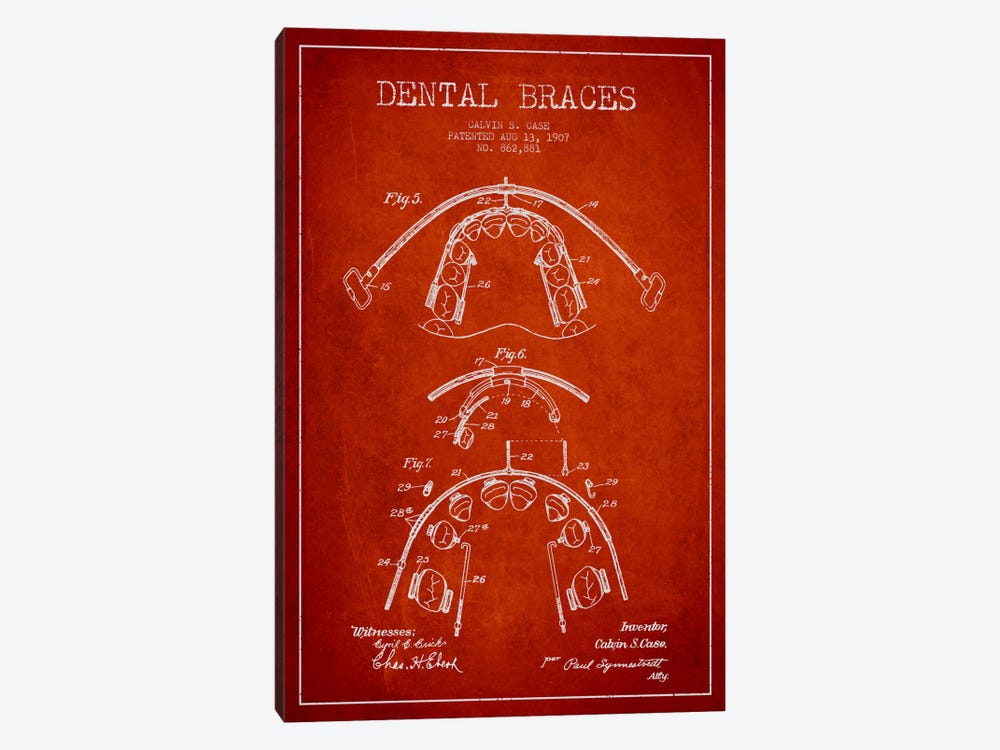 Dental Braces Red Patent Blueprint by Aged Pixel 1-piece Art Print