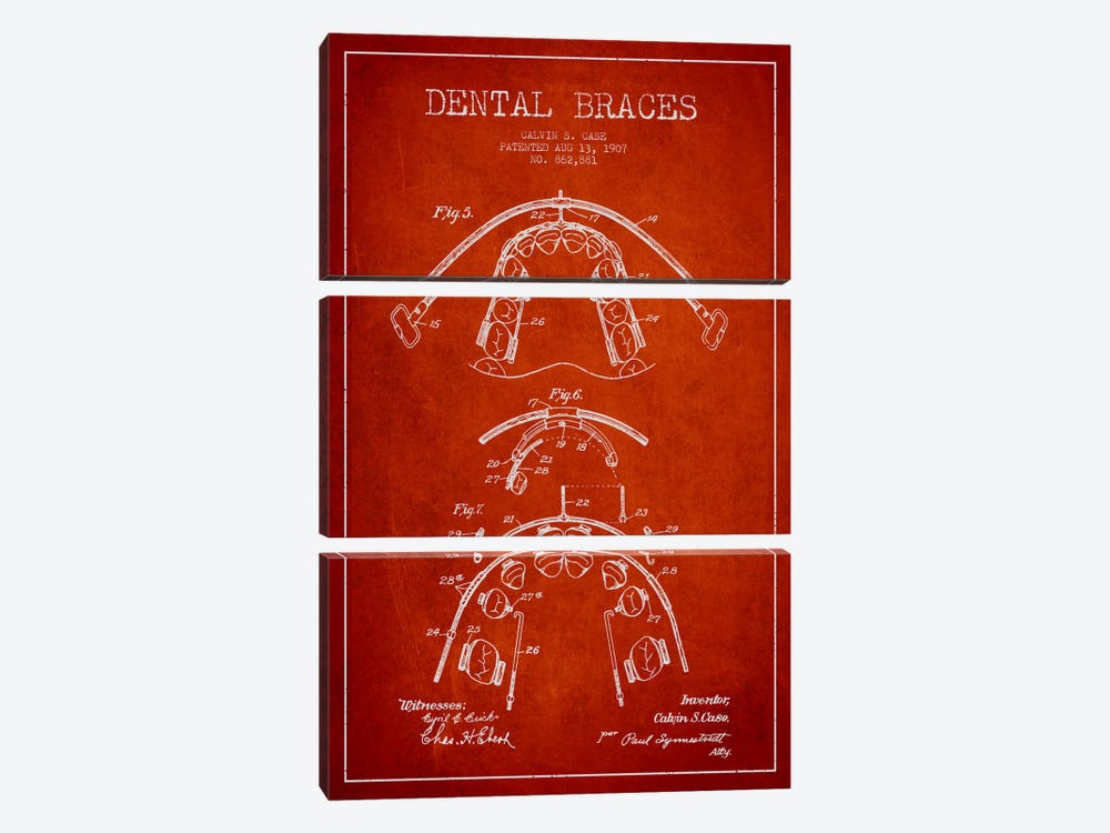 Dental Braces Red Patent Blueprint by Aged Pixel 3-piece Canvas Art Print