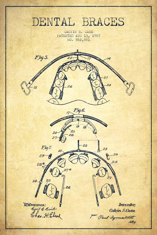 Dental Braces Vintage Patent Blueprint by Aged Pixel wall art