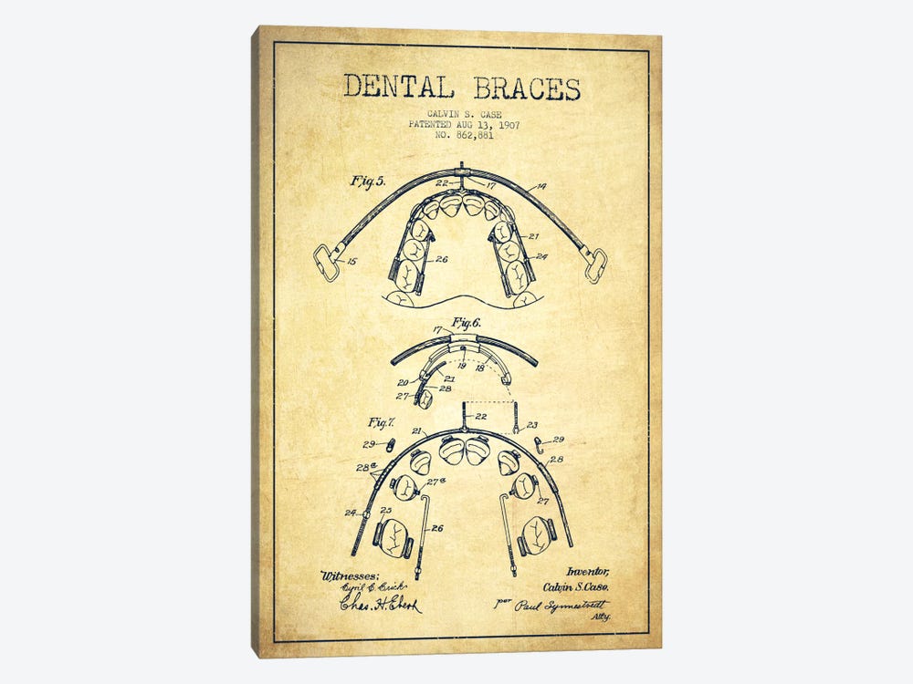 Dental Braces Vintage Patent Blueprint 1-piece Canvas Art