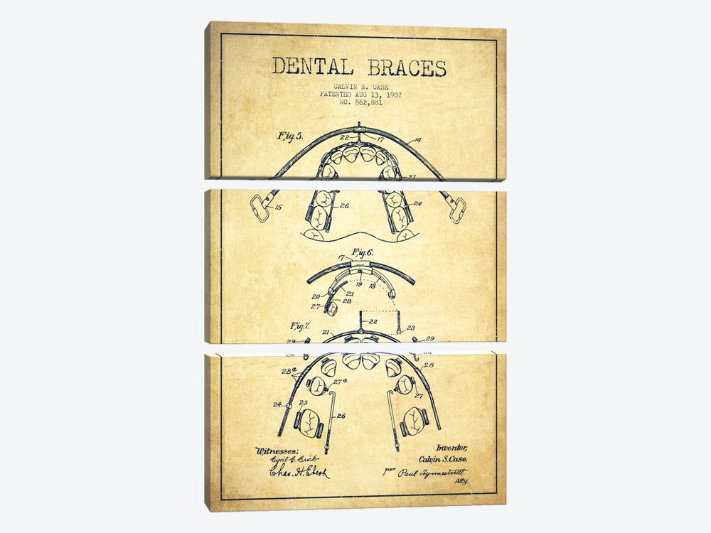 Dental Braces Vintage Patent Blueprint by Aged Pixel 3-piece Canvas Wall Art