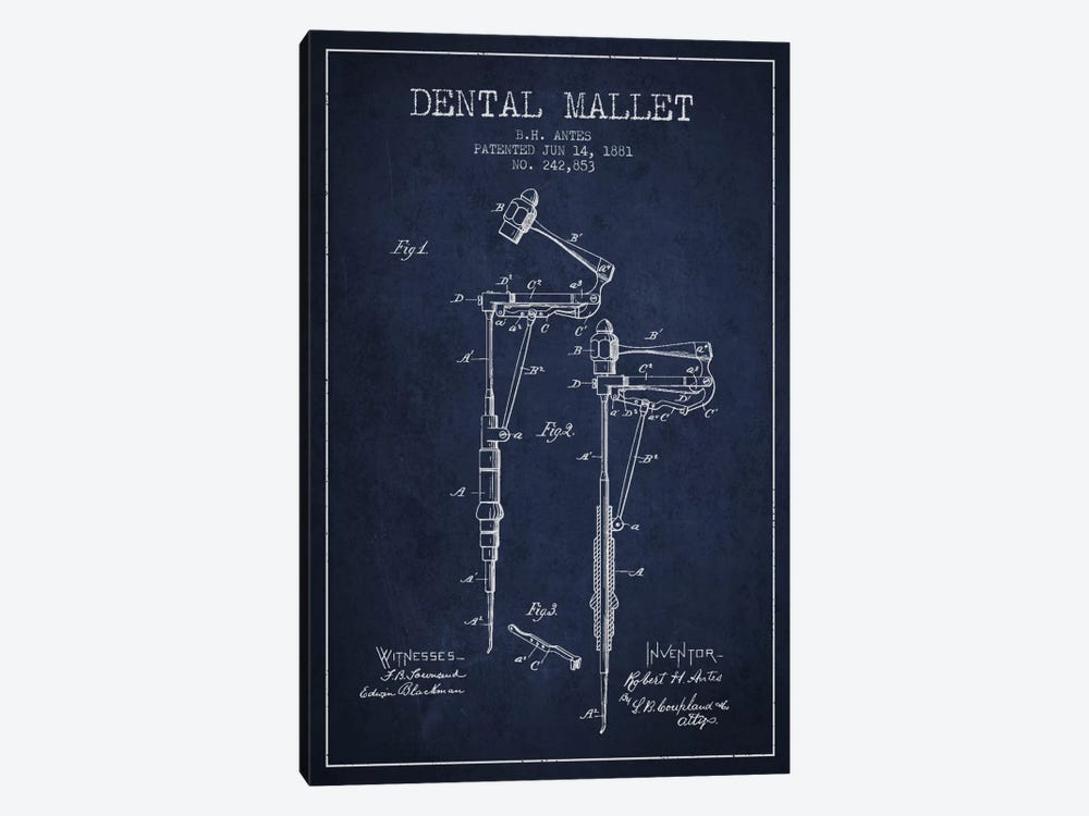 Dental Mallet Navy Blue Patent Blueprint by Aged Pixel 1-piece Art Print