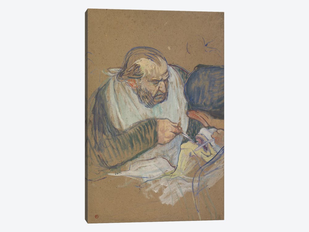 Dr. Péan Operating, 1891-92 by Henri de Toulouse-Lautrec 1-piece Canvas Print