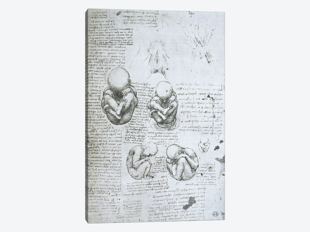 Five Views of a Foetus in the Womb, facsimile copy  by Leonardo da Vinci 1-piece Canvas Art Print