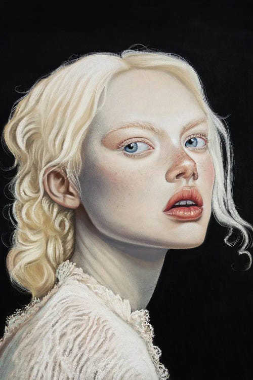 Albino Girl In Lace Dress