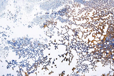 Coral Blooming by Petra Meikle de Vlas canvas print