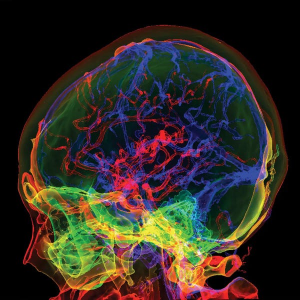 Brain Blood Vessels, 3D Ct Angiogram