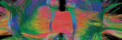 Science Photo Library - Canvas Prints: Brain Fibres Front View, Dti Scan by Science Photo Library