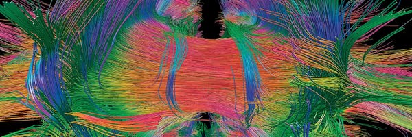 Science Photo Library: Brain Fibres Front View, Dti Scan by Science Photo Library