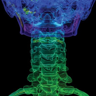 Science Photo Library - Canvas Prints: Cervical Spine Anatomy, 3D Ct Scan by Science Photo Library
