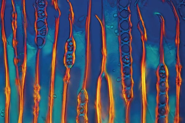Science Photo Library: Cypress Tree Stalk, Light Micrograph by Science Photo Library