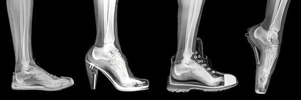 Different Shoes X-Ray