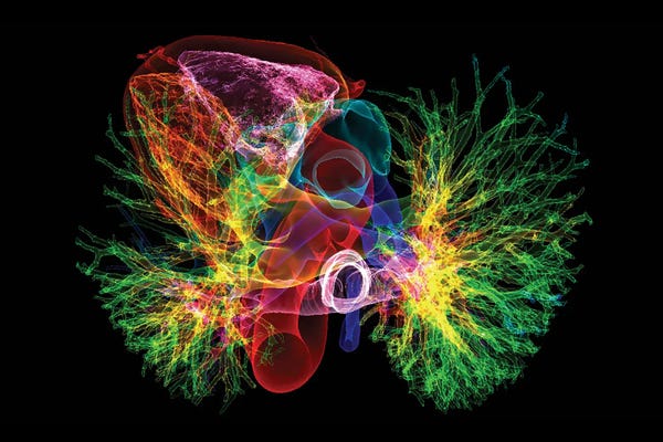 Healthy Heart And Lungs, 3D CT Scan