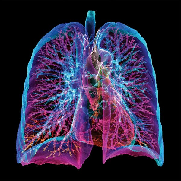 Heart And Lungs, 3D CT Scan