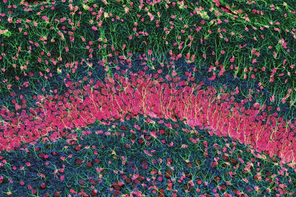 Science Photo Library: Hippocampus Brain Tissue by Science Photo Library