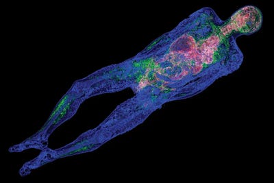 Canvas Print: Human Body, Pet-CT Scan by Science Photo Library - thumbnail