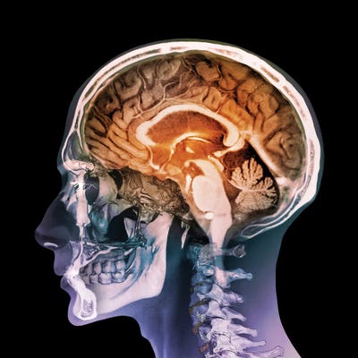 Science Photo Library - Canvas Prints: Human Head, Mri And 3D CT Scans by Science Photo Library