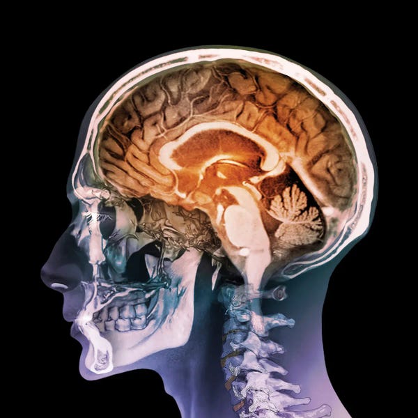 Human Head, Mri And 3D CT Scans