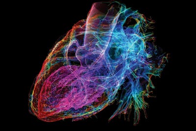 Canvas Print: Human Heart I, 3D CT Scan by Science Photo Library - thumbnail