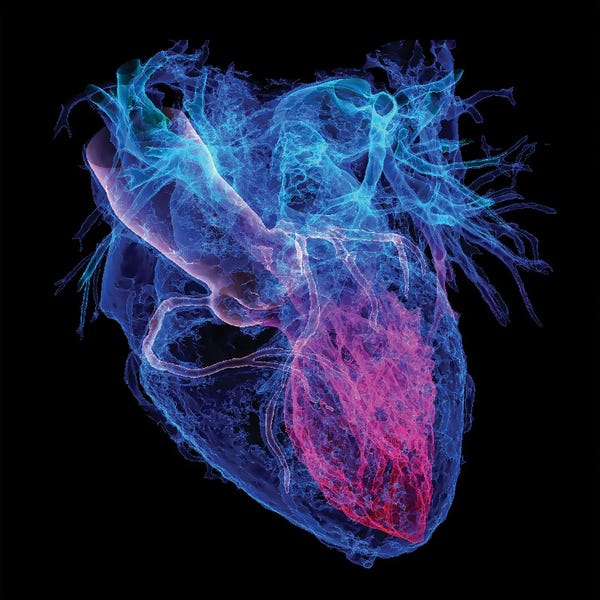 Human Heart II, 3D CT Scan