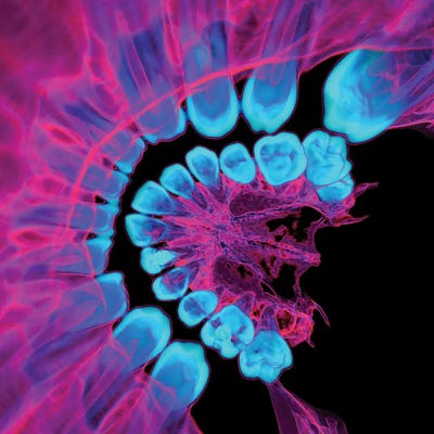 Canvas Print: Human Teeth, 3D CT Scan by Science Photo Library - thumbnail