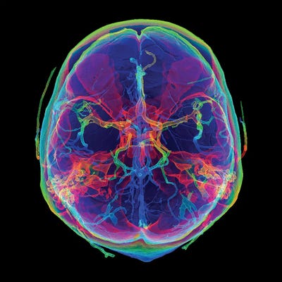Canvas Print: Intracranial Blood Vessels, 3D CT Scan by Science Photo Library - thumbnail