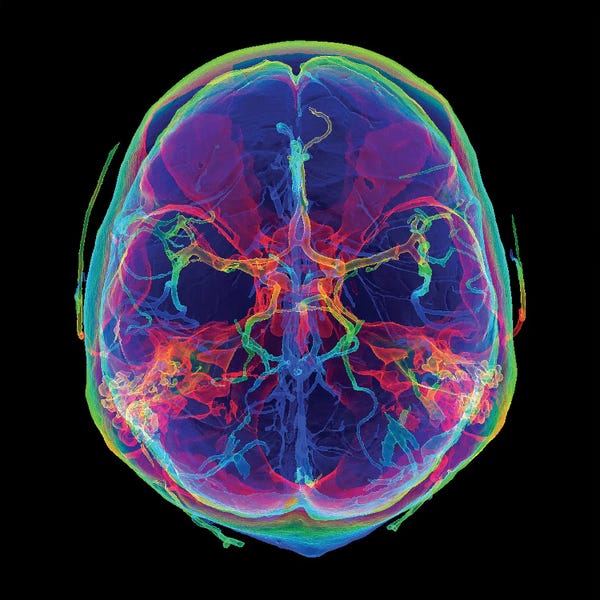 Science Photo Library: Intracranial Blood Vessels, 3D CT Scan by Science Photo Library