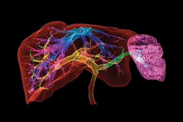 Liver And Spleen And Blood Vessels, 3D CT Scan
