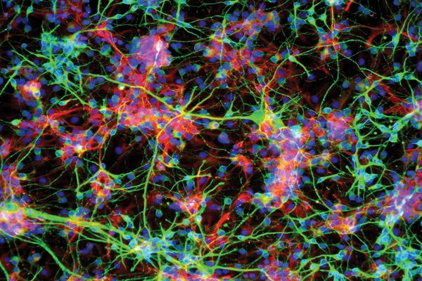 Science Photo Library: Neural Stem Cells, Light Micrograph by Science Photo Library