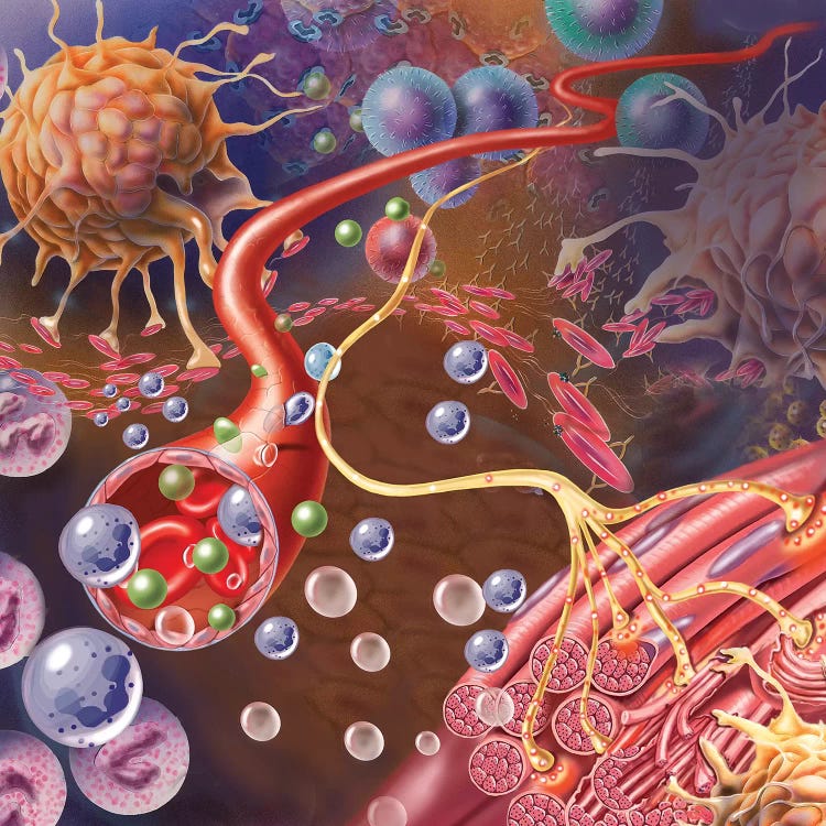 Nerve Ending, Seen In Lower Right, Sends Pain Message From Injured Muscle