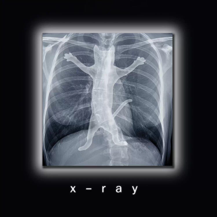 X-ray by Tummeow wall art