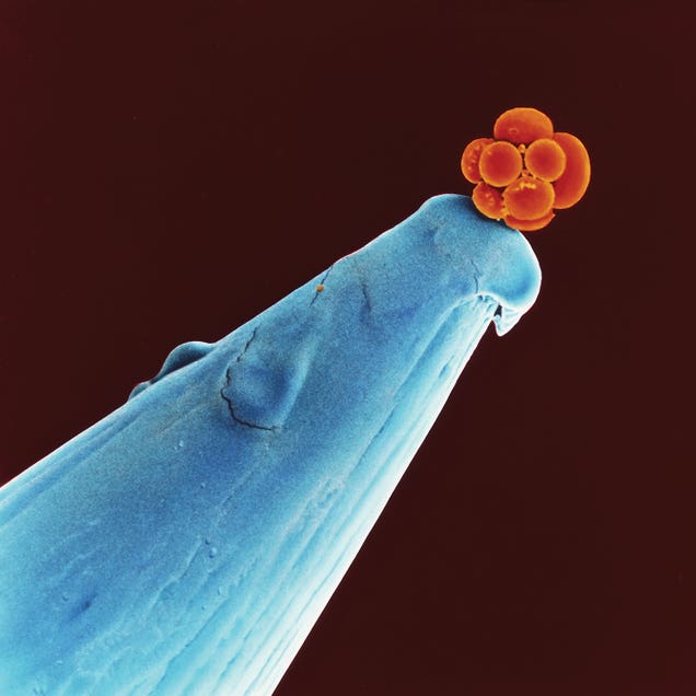 16-Cell Human Embryo On A Pin, SEM by Science Photo Library